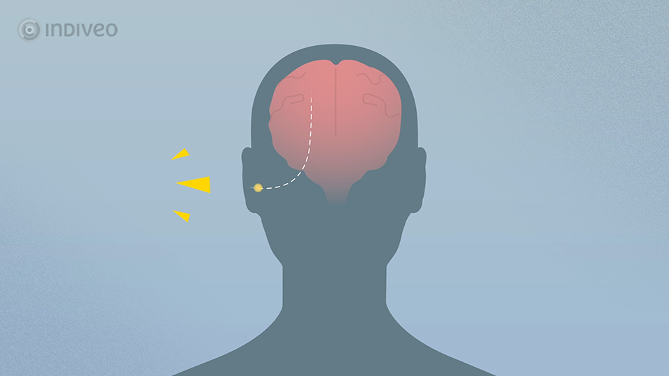 Tinnitus