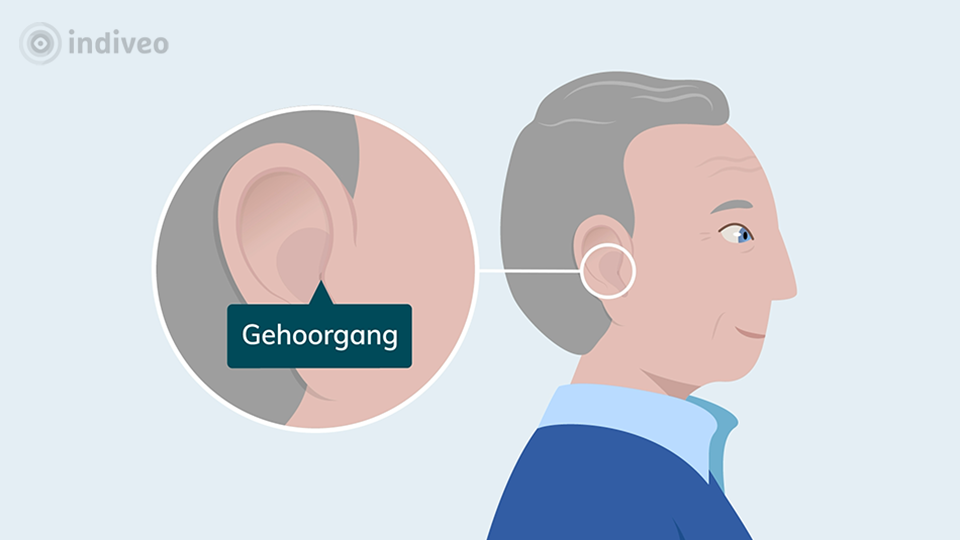 Gehoorgang wijder maken (meatusplastiek)